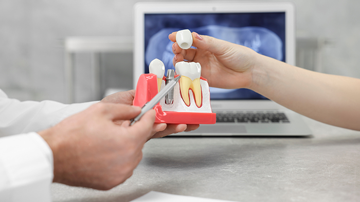 Dental implant dentists in Ann Arbor MI